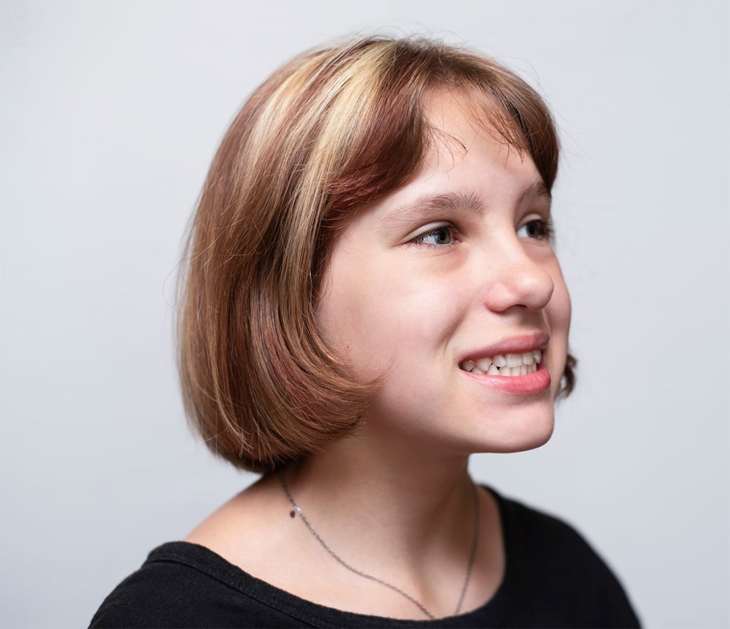 What is TMJ Disorder & How Can Your Dentist Help? Kenmore, WA