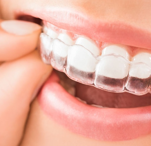5-popular-cosmetic-dentistry-treatments-banner